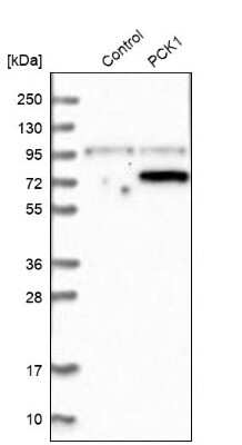 Western Blot: PCK1 Antibody [NBP1-80927]