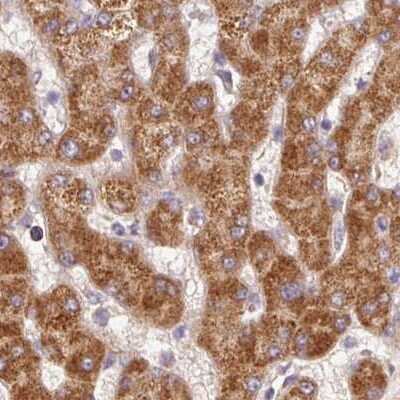 Immunohistochemistry-Paraffin: PCK2 Antibody [NBP2-33606]