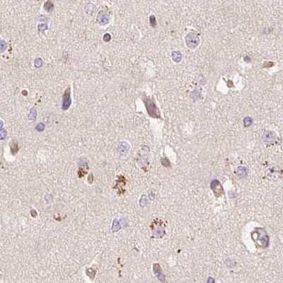Immunohistochemistry-Paraffin: PCK2 Antibody [NBP2-33685]