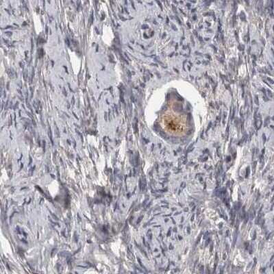 Immunohistochemistry-Paraffin: PCM1 Antibody [NBP1-87196]