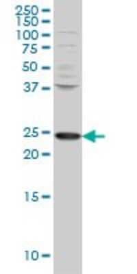 Western Blot: PCMT1 Antibody (1D6) [H00005110-M02]