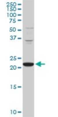 Western Blot: PCMT1 Antibody (1D6) [H00005110-M02]