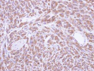 Immunohistochemistry-Paraffin: PCMT1 Antibody [NBP1-33019]