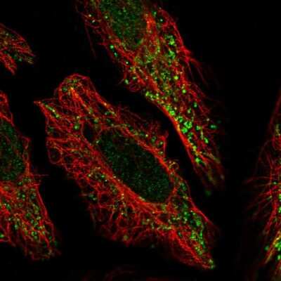Immunocytochemistry/ Immunofluorescence: PCMTD2 Antibody [NBP2-31698]