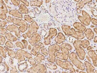 Immunohistochemistry-Paraffin: PCMTD2 Antibody [NBP3-06361]