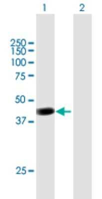 Western Blot: PCMTD2 Antibody [H00055251-B01P]