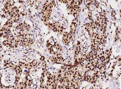 Immunohistochemistry-Paraffin: PCNA Antibody (144) [NBP2-90058]
