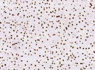 Immunohistochemistry-Paraffin: PCNA Antibody (144) [NBP2-90058]