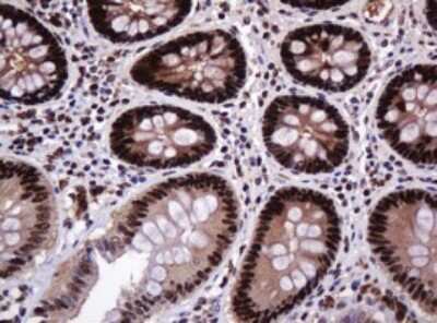 Immunohistochemistry: PCNA Antibody (OTI3D6) [NBP2-46342]