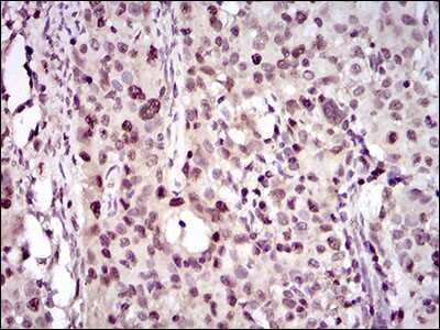 Immunohistochemistry-Paraffin: PCNA Antibody (7H4F8) - BSA Free [NBP2-37414]