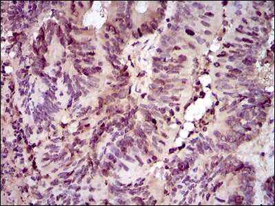Immunohistochemistry-Paraffin: PCNA Antibody (7H4F8) - BSA Free [NBP2-37414]