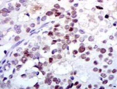 Immunohistochemistry-Paraffin: PCNA Antibody (7H4F8) - BSA Free [NBP2-37414]