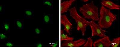 Immunocytochemistry/ Immunofluorescence: PCNA Antibody [NBP1-32075]