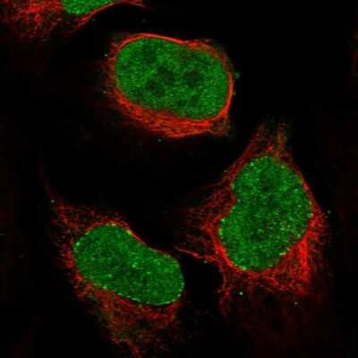Immunocytochemistry/ Immunofluorescence: PCNA Antibody [NBP1-89503]