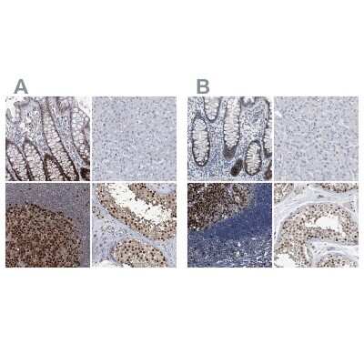 Immunohistochemistry-Paraffin: PCNA Antibody [NBP1-89503]
