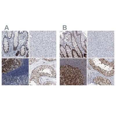Immunohistochemistry-Paraffin: PCNA Antibody [NBP1-89504]