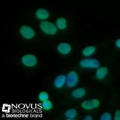 Immunocytochemistry/ Immunofluorescence: PCNA Antibody (PC10) [NB500-106]