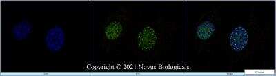 Immunocytochemistry/ Immunofluorescence: PCNA Antibody (PC10) [NB500-106]