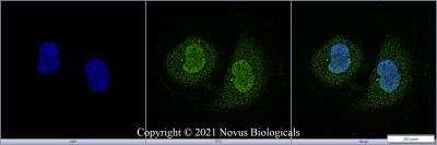 Immunocytochemistry/ Immunofluorescence: PCNA Antibody (PC10) [NB500-106]