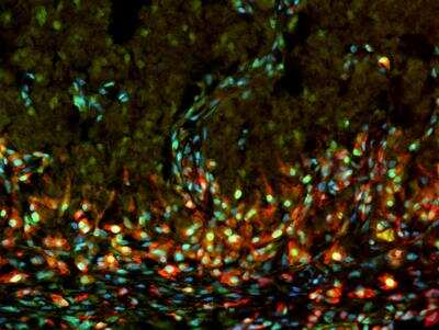 Immunohistochemistry-Frozen: PCNA Antibody (PC10) [NB500-106]