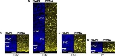 Immunohistochemistry: PCNA Antibody (PC10) [NB500-106]
