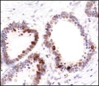 Immunohistochemistry-Paraffin: PCNA Antibody (PC10) [NB500-106]