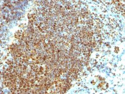 Immunohistochemistry-Paraffin: PCNA Antibody (PCNA/694) - IHC-Prediluted [NBP2-48284]