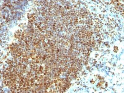 Immunohistochemistry-Paraffin: PCNA Antibody (PCNA/694) [NBP2-44731]