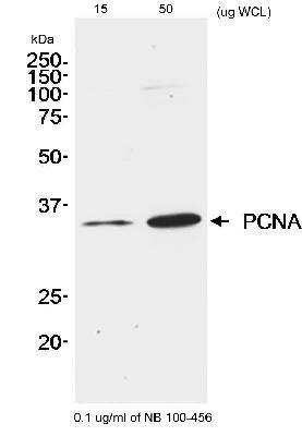 Western Blot: PCNA Antibody [NB100-456]