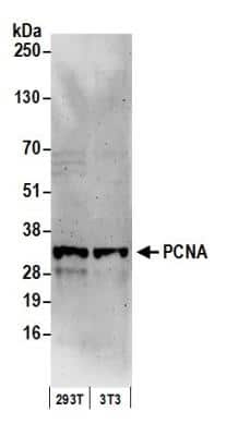 Western Blot: PCNA Antibody [NB100-456]