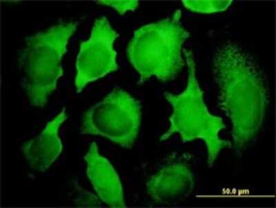 Immunocytochemistry/ Immunofluorescence: PCNA associated factor Antibody (3C11-1F11) [H00009768-M01]