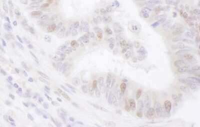 Immunohistochemistry-Paraffin: PCNA associated factor Antibody [NBP2-32112]