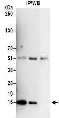 Immunoprecipitation: PCNA associated factor Antibody [NBP2-32117]