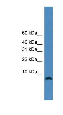 Western Blot: PCNA associated factor Antibody [NBP1-80555]