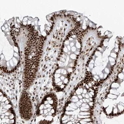 Immunohistochemistry-Paraffin: PCNP Antibody [NBP1-86312]