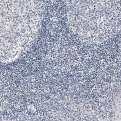 Immunohistochemistry-Paraffin: PCP4 Antibody (CL5306) [NBP2-61410]