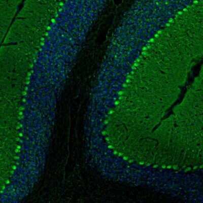 Immunohistochemistry: PCP4 Antibody [NBP1-80929]