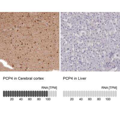 Immunohistochemistry-Paraffin: PCP4 Antibody [NBP1-80929]