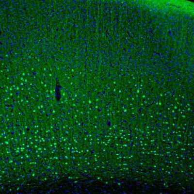 Immunohistochemistry: PCP4 Antibody [NBP1-80929]