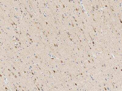 Immunohistochemistry-Paraffin: PCP4 Antibody [NBP3-14649]