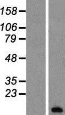 Western Blot: PCP4 Overexpression Lysate [NBP2-07654]
