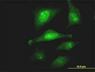 Immunocytochemistry/ Immunofluorescence: PCSK1N Antibody (1E9) [H00027344-M02]