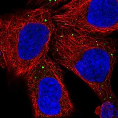 Immunocytochemistry/ Immunofluorescence: PCSK1N Antibody [NBP2-49423]