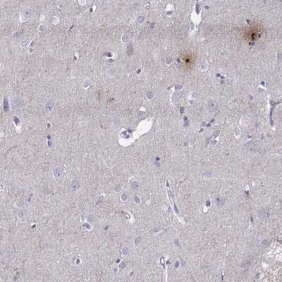 Immunohistochemistry-Paraffin: PCSK1N Antibody [NBP1-80797]
