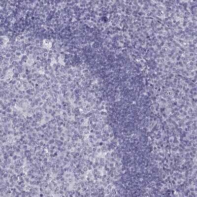 Immunohistochemistry-Paraffin: PCSK1N Antibody [NBP1-80797]