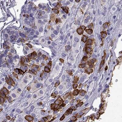 Immunohistochemistry-Paraffin: PCSK1N Antibody [NBP1-80797]