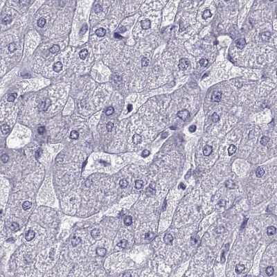 Immunohistochemistry-Paraffin: PCSK1N Antibody [NBP1-80797]