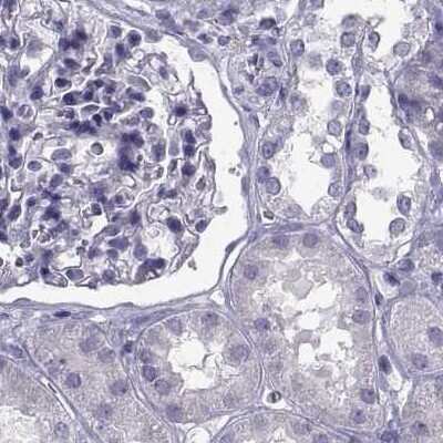 Immunohistochemistry-Paraffin: PCSK1N Antibody [NBP1-80797]