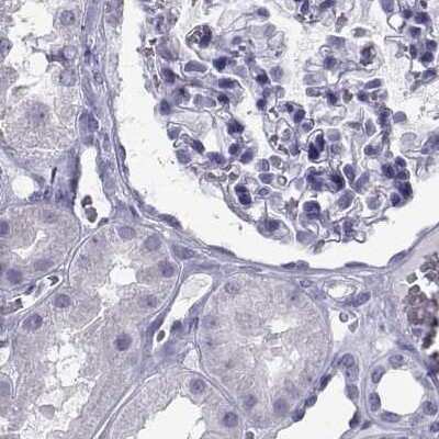 Immunohistochemistry-Paraffin: PCSK1N Antibody [NBP2-49423]