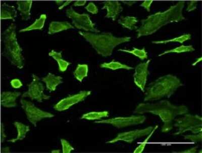 Immunocytochemistry/ Immunofluorescence: PCTAIRE1 Antibody (2E5) [H00005127-M02]